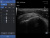 Healcerion Sonon 300L Аппарат УЗИ Healcerion Sonon 300L Аппарат УЗИ