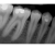 Dr.Suni Plus - самый тонкий датчик в мире