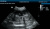 Mindray DP-30 Vet Аппарат УЗИ Mindray DP-30 Vet Аппарат УЗИ