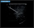Esaote MyLab x5 Аппарат УЗИ Esaote MyLab x5 Аппарат УЗИ