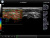 UltraSonix SonixTouch Аппарат УЗИ UltraSonix SonixTouch Аппарат УЗИ