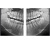 RAYSCAN Symphony Alpha OCS – ортопантомограф c цефалостатом (One Shot), 30х25 см RAYSCAN Symphony Alpha OCS – ортопантомограф c цефалостатом (One Shot), 30х25 см