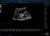 Mindray Resona 7 Аппарат УЗИ Mindray Resona 7 Аппарат УЗИ