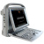 Chison SonoTouch 50 Аппарат УЗИ Chison SonoTouch 50 Аппарат УЗИ